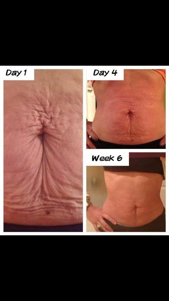 BODY SPA TREATMENTS FOR THE STOMACH